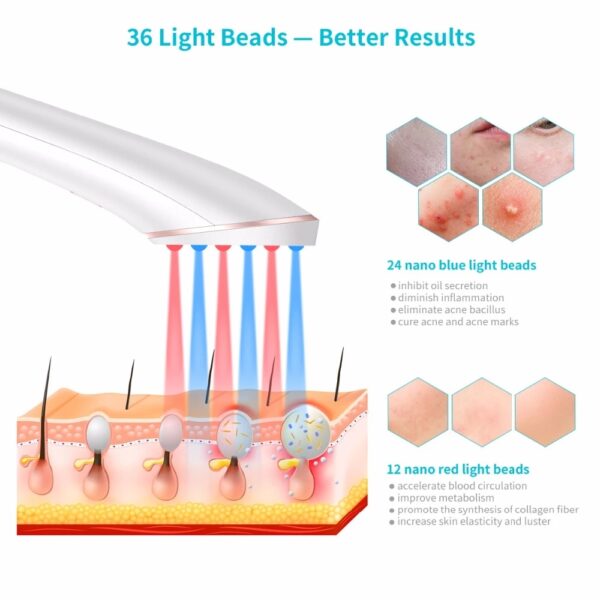 Acne Light Therapy Xpreen Wireless Rechargeable Light Acne Treatment Device Acne Clearing Eraser with Blue Light and Red Light - Image 8