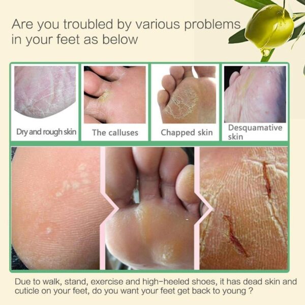 Aloe Vera Foot Mask Peeling For Legs Feet Mask Exfoliating Socks Scrub For Pedicure Anti Crack Heel Remove Skin Foot Patch - Image 4