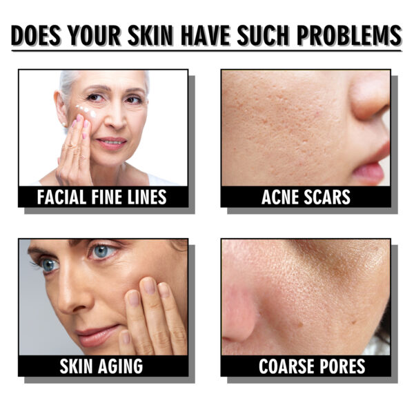 Snail Cream Fading Wrinkle French Lines Replenishment Firming Skin Anti-Aging - Image 5