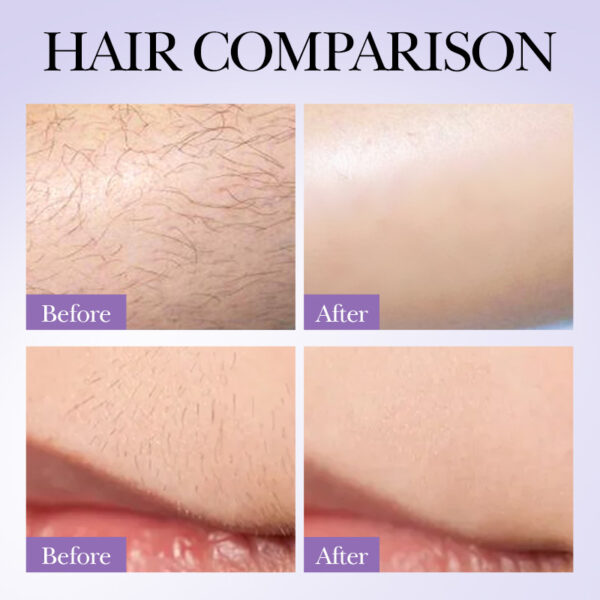 Hair Growth Inhibition Armpit Leg Hair Spray - Image 2